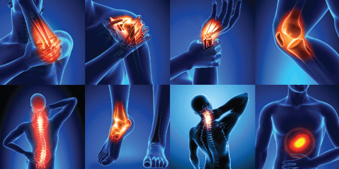 Muscles and Bones Pain