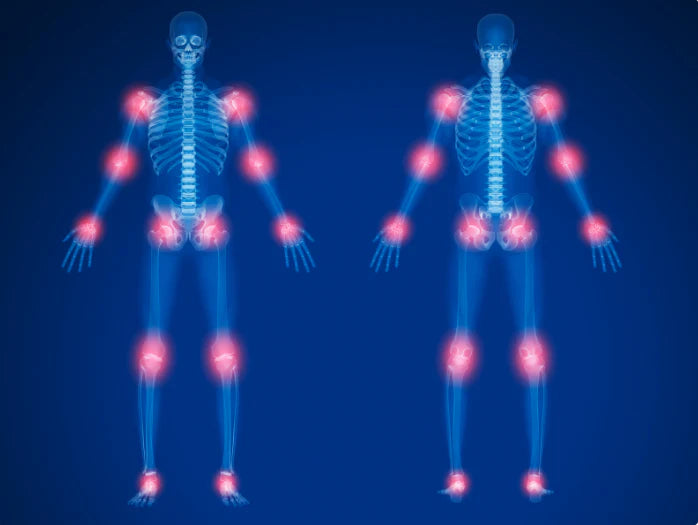 Osteoarthritis