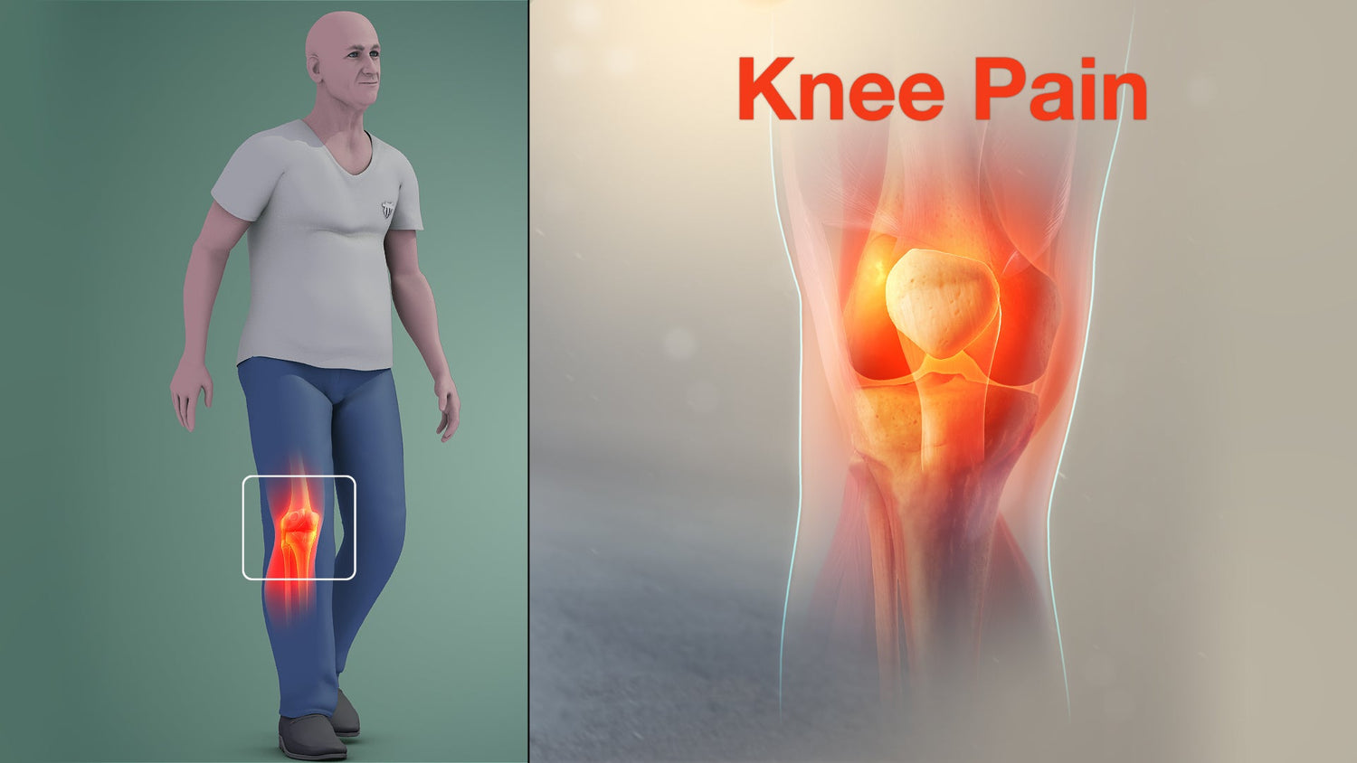 Arthritis, Joint and Knee Pain